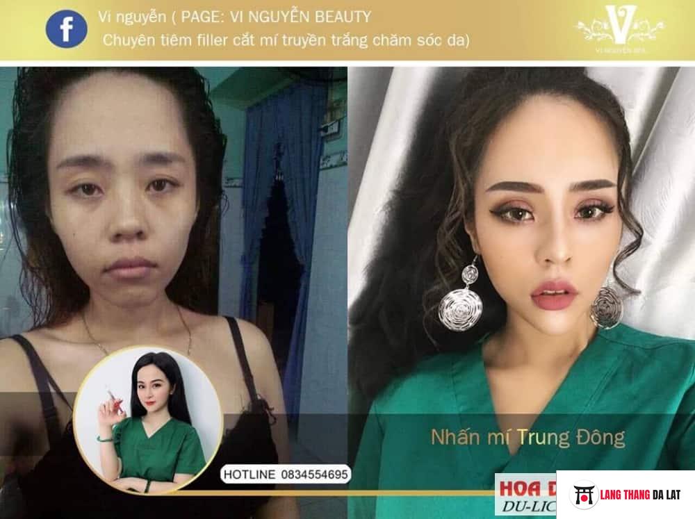 Vi Nguyễn Beauty Spa Đà Lạt